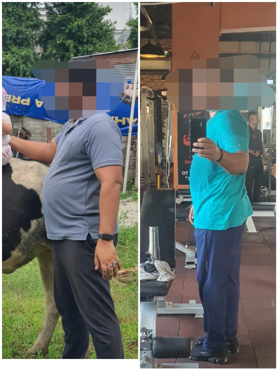 Rahul K. - client transformation with Dt. Srushti Bothra, Surat